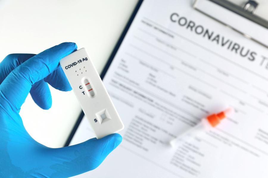 Covid-19 All You Need To Know About RT-PCR Tests